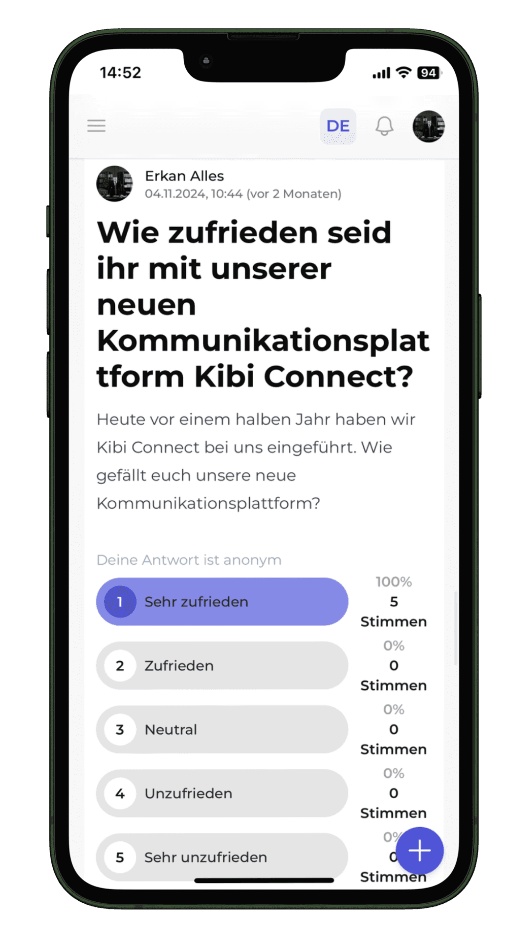 Kibi Connect Umfrage-Tool mit verschiedenen Fragetypen und automatischer Auswertung